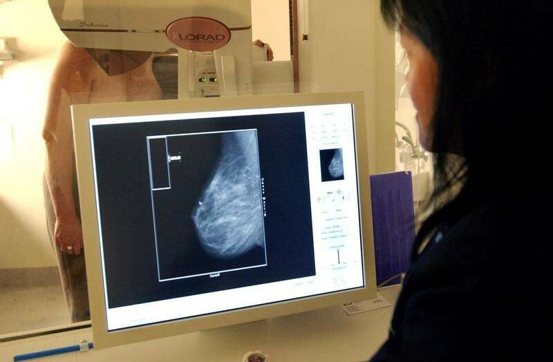 The temporary closure of BreastScreen services across NSW is not an excuse to ignore symptoms warns Breast Cancer Network Australia (BCNA). Photo: file.